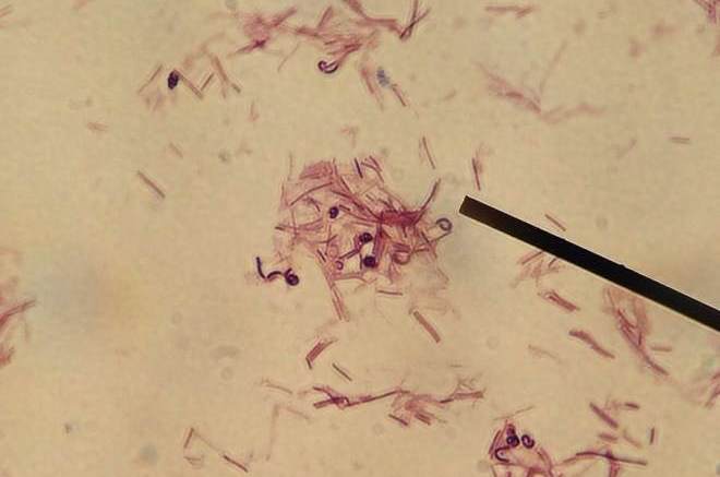 Lactobacillus paracasei và ImmunePath IP